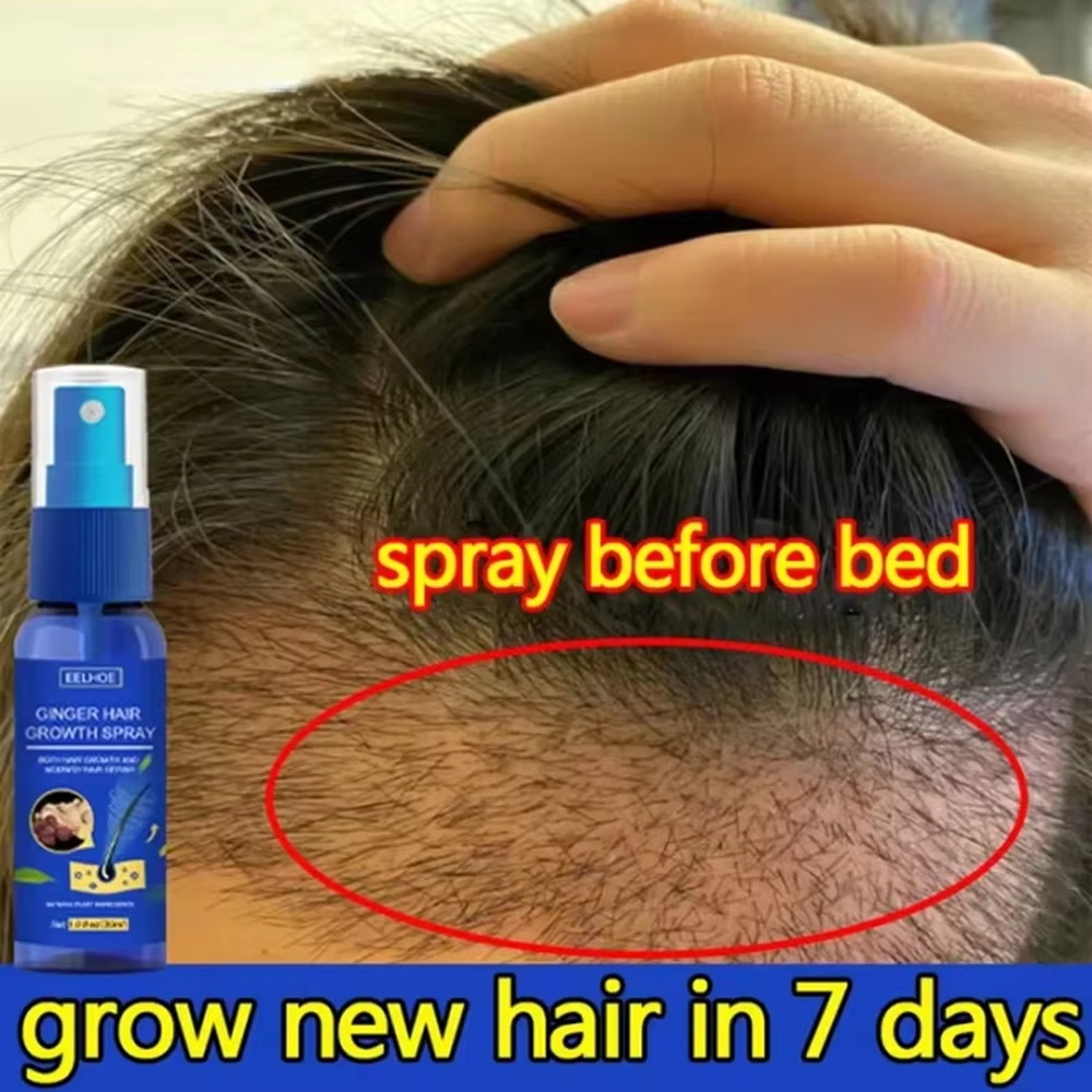 Fast Ginger Hair Growth Spray  - Growth Factor Serum 评论和价格