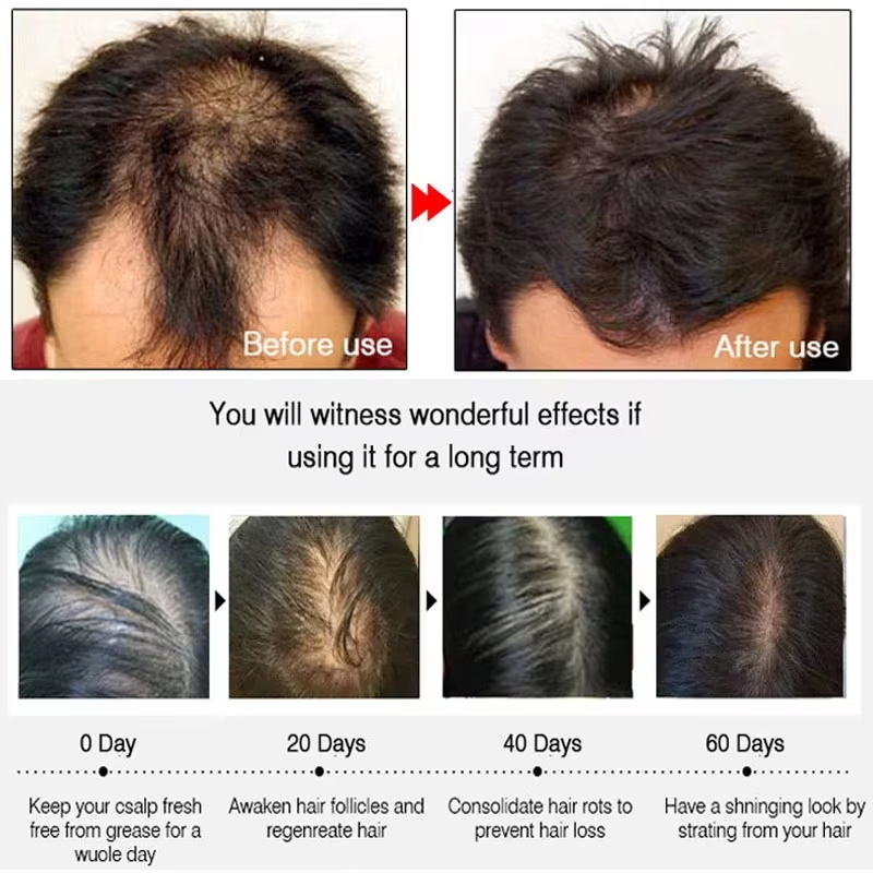 Fast Ginger Hair Growth Spray  - Growth Factor Serum 评论和价格